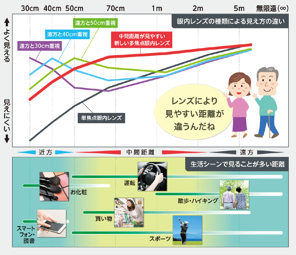 眼内レンズの種類と生活シーンの関係