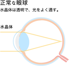 正常な眼球