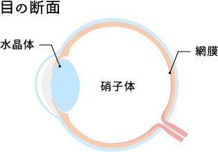 硝子体（しょうしたい）とは目の組織の中にある 透明なゼリー状部分を指します。